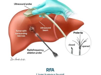 WhatsApp Image 2025-11-03 at 9.12.31 PM WhatsApp Image 2025-11-03 at 9.12.31 PM
