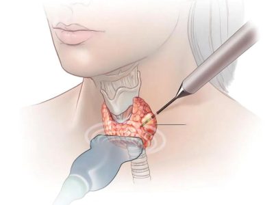 WhatsApp Image 2025-11-03 at 9.46.04 PM WhatsApp Image 2025-11-03 at 9.46.04 PM